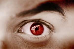 Olhos vermelhos em fotos Olhos vermelhos em fotos
